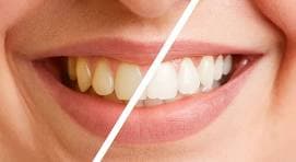 Teeth Health care
